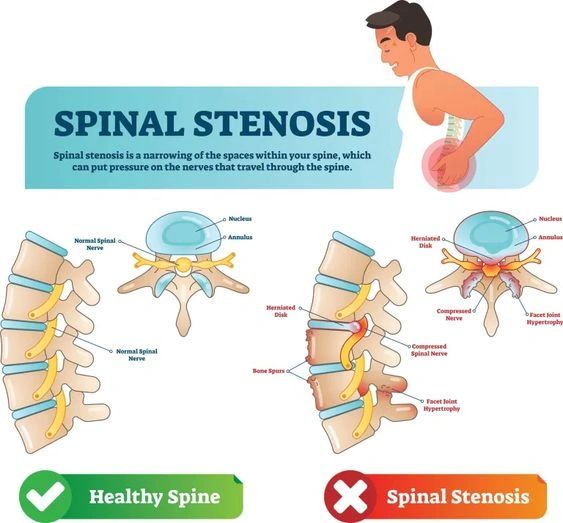 Paincaremedicine